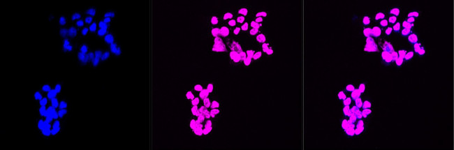 CHRNA5 Antibody in Immunocytochemistry (ICC/IF)