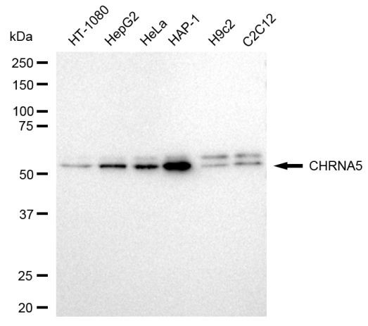 CHRNA5 Antibody in Western Blot (WB)