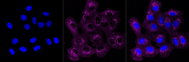 ACTR1B Antibody in Immunocytochemistry (ICC/IF)