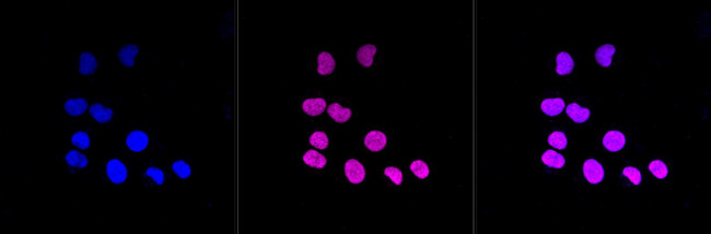 ATF4 Antibody in Immunocytochemistry (ICC/IF)