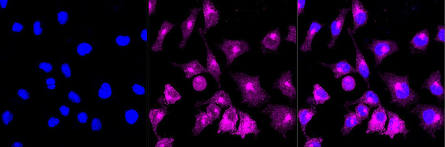 ADAMTS13 Antibody in Immunocytochemistry (ICC/IF)