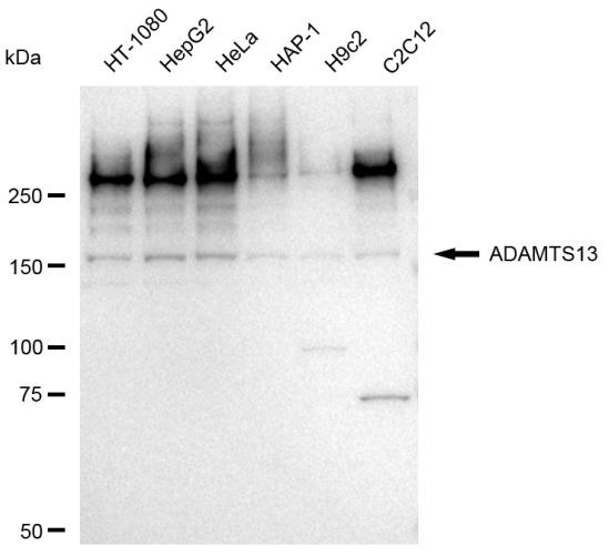 ADAMTS13 Antibody in Western Blot (WB)