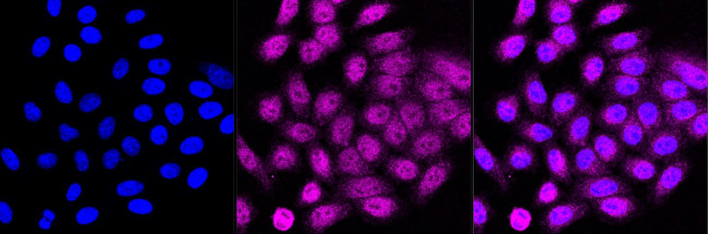 JARID2 Antibody in Immunocytochemistry (ICC/IF)