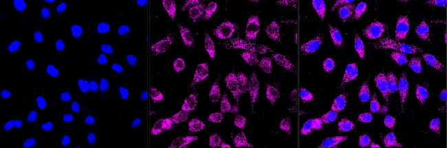 GlyT2 Antibody in Immunocytochemistry (ICC/IF)