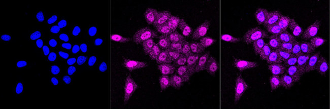 Tensin 4 Antibody in Immunocytochemistry (ICC/IF)