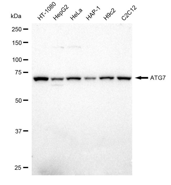 ATG7 Antibody in Western Blot (WB)