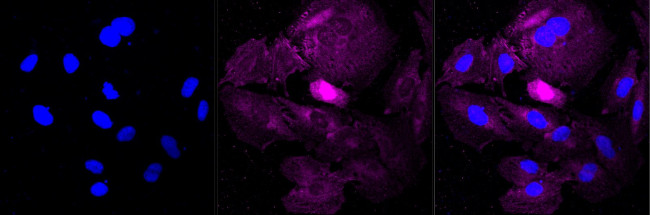 PKC mu Antibody in Immunocytochemistry (ICC/IF)