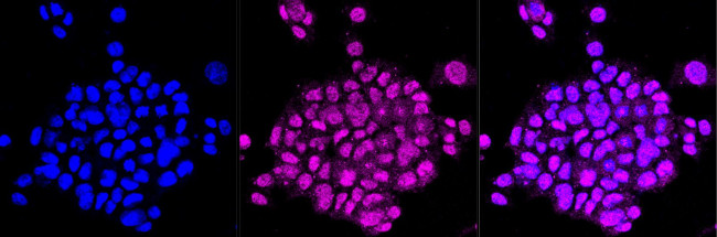 Synapsin II Antibody in Immunocytochemistry (ICC/IF)