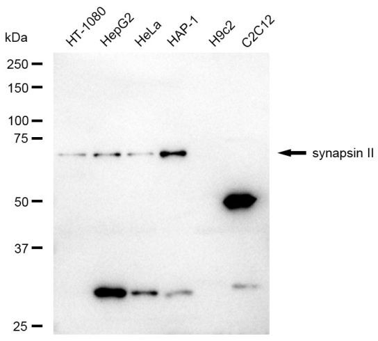 Synapsin II Antibody in Western Blot (WB)