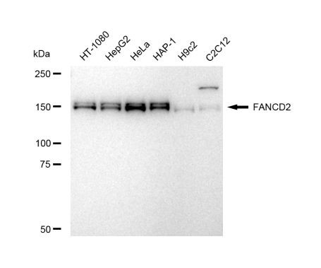 FANCD2 Antibody in Western Blot (WB)