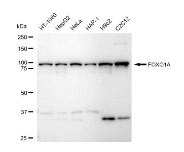 FOXO1 Antibody in Western Blot (WB)