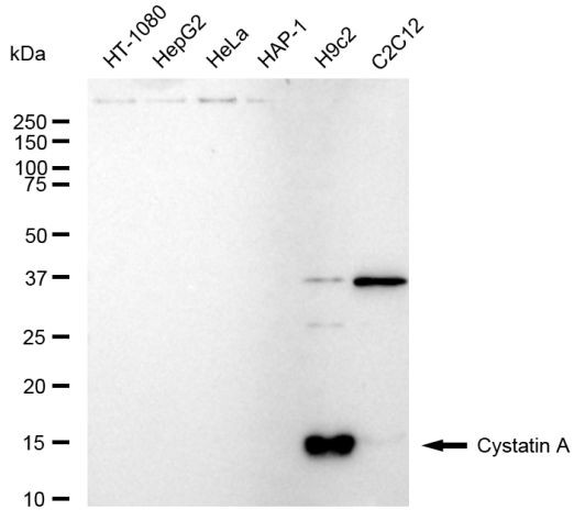 Cystatin A Antibody in Western Blot (WB)