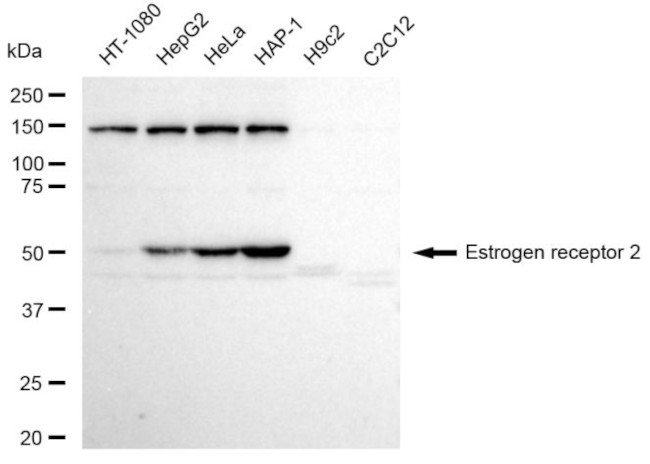 Estrogen Receptor beta Antibody in Western Blot (WB)