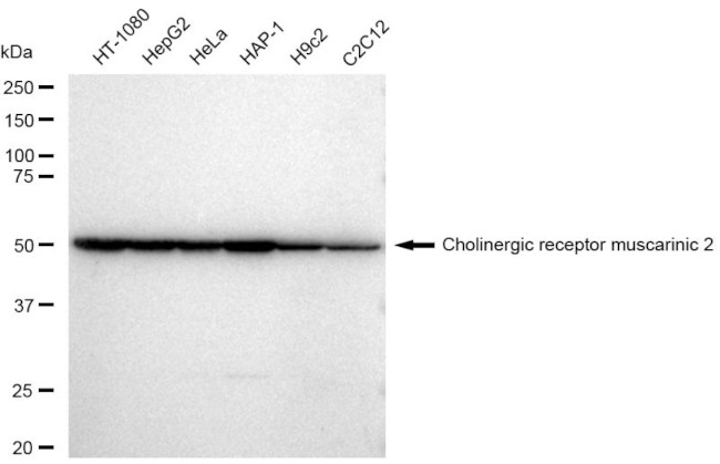 CHRM2 Antibody in Western Blot (WB)