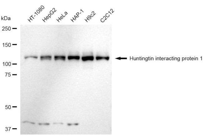 HIP1 Antibody in Western Blot (WB)