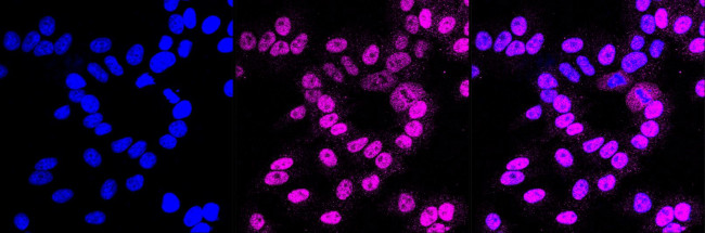 ETS1 Antibody in Immunocytochemistry (ICC/IF)