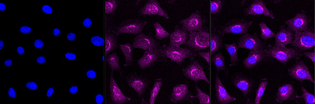 Golgin-97 Antibody in Immunocytochemistry (ICC/IF)