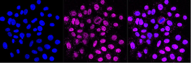 FOXO1 Antibody in Immunocytochemistry (ICC/IF)