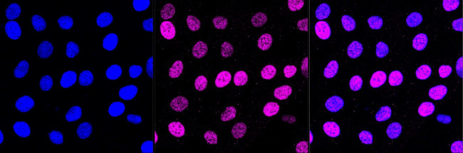 SIRT6 Antibody in Immunocytochemistry (ICC/IF)