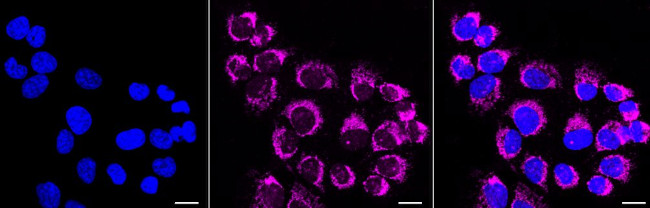 Prohibitin Antibody in Immunocytochemistry (ICC/IF)