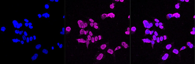 ErbB4 Antibody in Immunocytochemistry (ICC/IF)