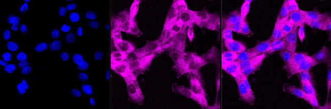 ATG7 Antibody in Immunocytochemistry (ICC/IF)