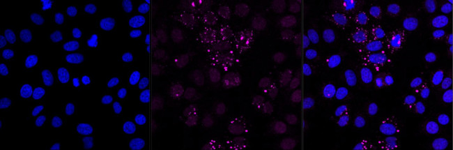 Prohibitin Antibody in Immunocytochemistry (ICC/IF)