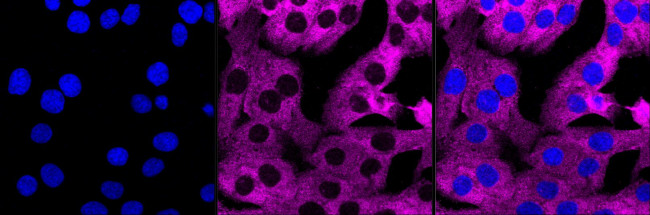 EIF2A Antibody in Immunocytochemistry (ICC/IF)