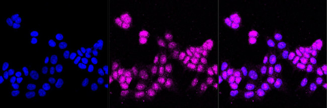 AGTR1 Antibody in Immunocytochemistry (ICC/IF)