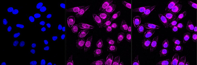 RAB9 Antibody in Immunocytochemistry (ICC/IF)