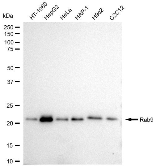 RAB9 Antibody in Western Blot (WB)