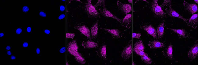 LC3A Antibody in Immunocytochemistry (ICC/IF)