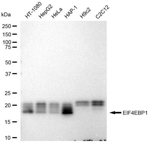 4EBP1 Antibody in Western Blot (WB)