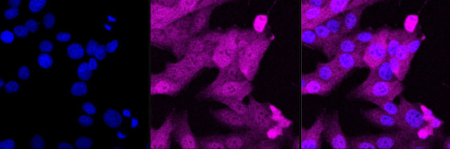 BCL-10 Antibody in Immunocytochemistry (ICC/IF)