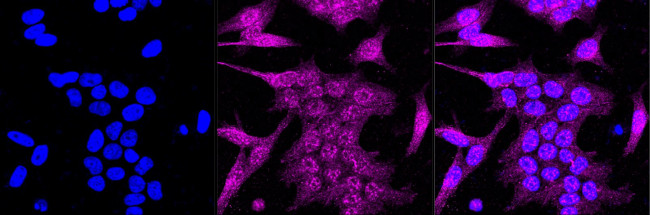 RSK1 Antibody in Immunocytochemistry (ICC/IF)