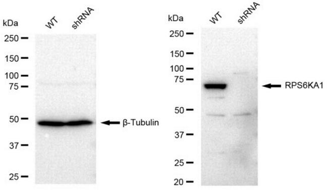 RSK1 Antibody