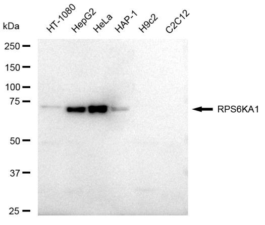 RSK1 Antibody in Western Blot (WB)