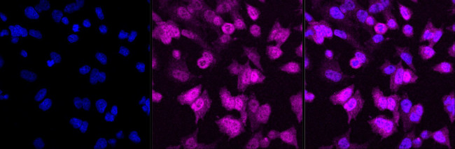 Galectin 3 Antibody in Immunocytochemistry (ICC/IF)