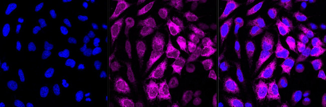 CD51 Antibody in Immunocytochemistry (ICC/IF)