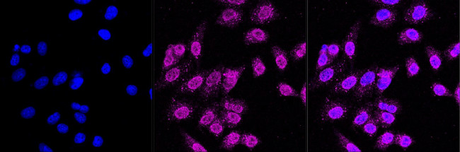 JAK1 Antibody in Immunocytochemistry (ICC/IF)