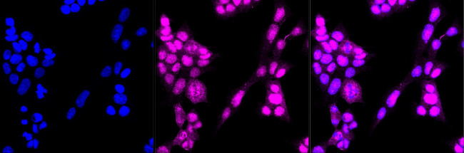 RAD51 Antibody in Immunocytochemistry (ICC/IF)