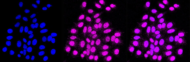 CDK2 Antibody in Immunocytochemistry (ICC/IF)