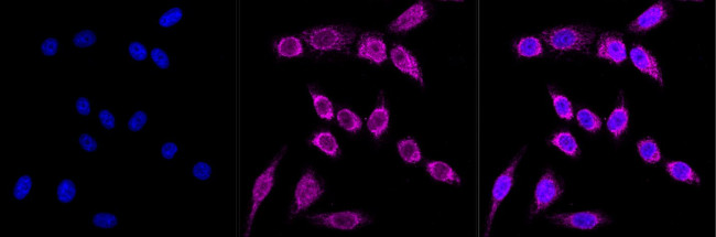 CPS1 Antibody in Immunocytochemistry (ICC/IF)