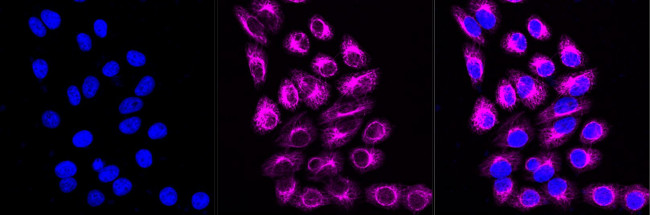 Cytokeratin 7 Antibody in Immunocytochemistry (ICC/IF)