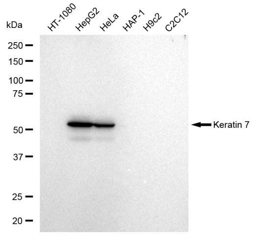 Cytokeratin 7 Antibody in Western Blot (WB)