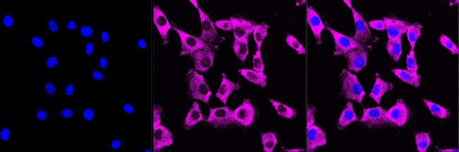 MEK1 Antibody in Immunocytochemistry (ICC/IF)