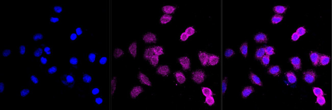 MEK1 Antibody in Immunocytochemistry (ICC/IF)