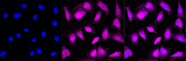 MEK3 Antibody in Immunocytochemistry (ICC/IF)