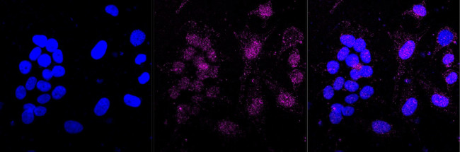 TAK1 Antibody in Immunocytochemistry (ICC/IF)