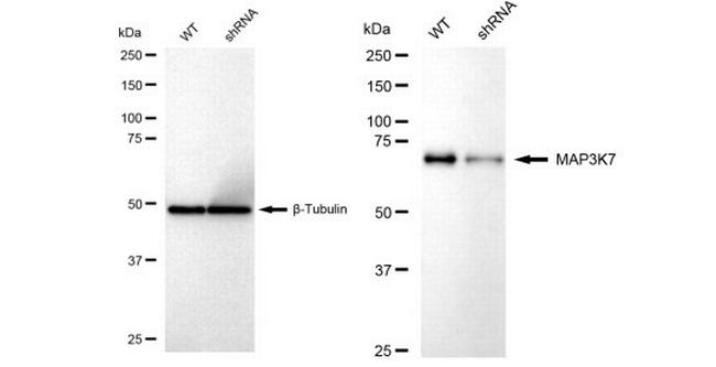 TAK1 Antibody